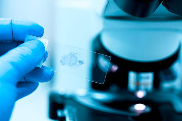 NatMet: два фермента могут запускать развитие рака поджелудочной