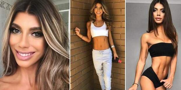 Девушка с церебральным параличом покорила Instagram