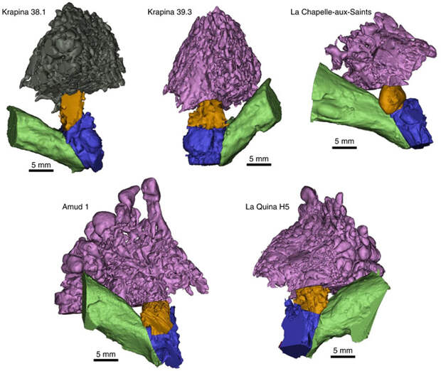 Рис. 1. Анатомические реконструкции полостей наружного и среднего уха пяти неандертальцев