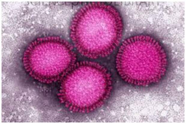 На фоне того, что в Испании грипп убил более 8 миллионов человек, болезнь была названа испанским гриппом болезни, инфекции, мир, прививки, факты, эпидемии