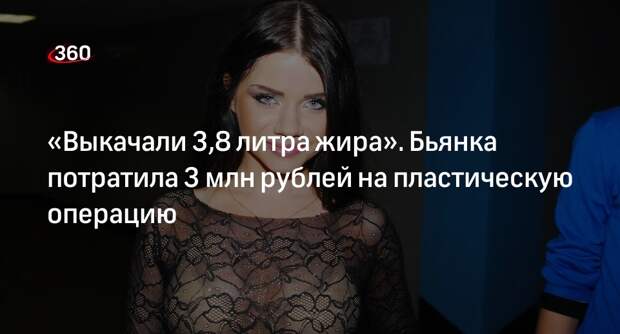 Певица Бьянка призналась, что потратила на пластику около 3 млн рублей