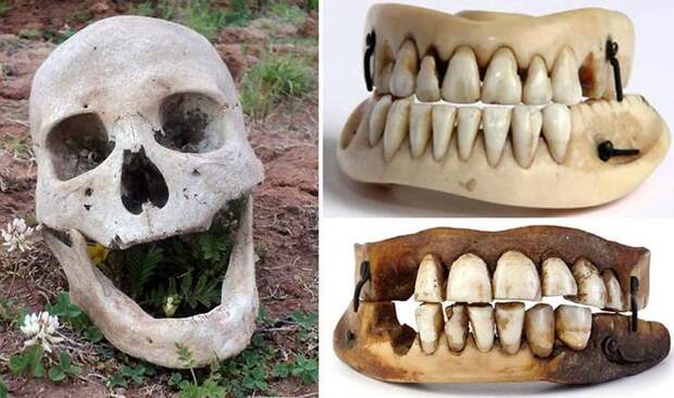 Зубы Ватерлоо интересное, люди, мистика, необычное, поступки, странности, факты, явления