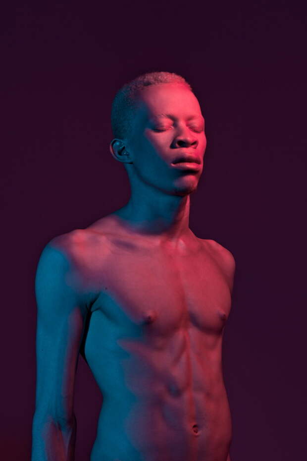 Модели-альбиносы в фотосессиях Justin Dingwall Модели-альбиносы в фотосессиях Justin Dingwall