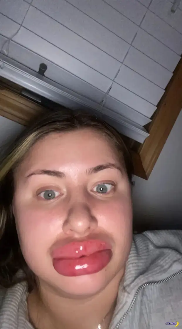 Слишком удачно качнула губья Слишком удачно качнула губья