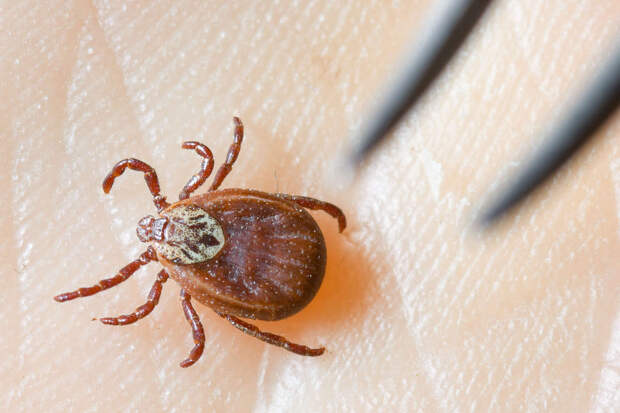 Prevention: боли в мышцах после укуса клеща могут указывать на инфекцию