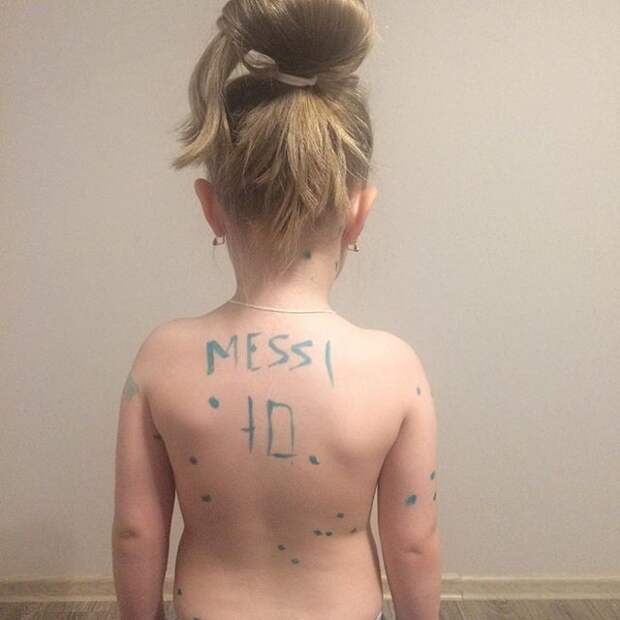 Ветрянка + папа =  папа, папа жжёт, прикол, родители, юмор