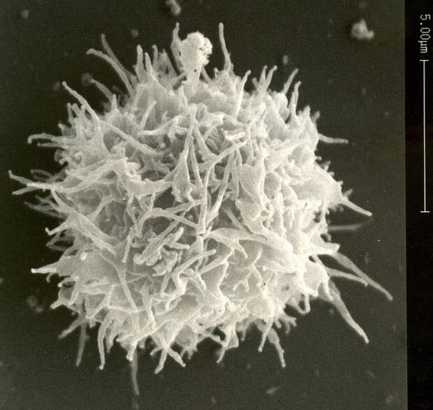 Acanthamoeba castellanii. (Фото Katz Lab / Flickr.com.)