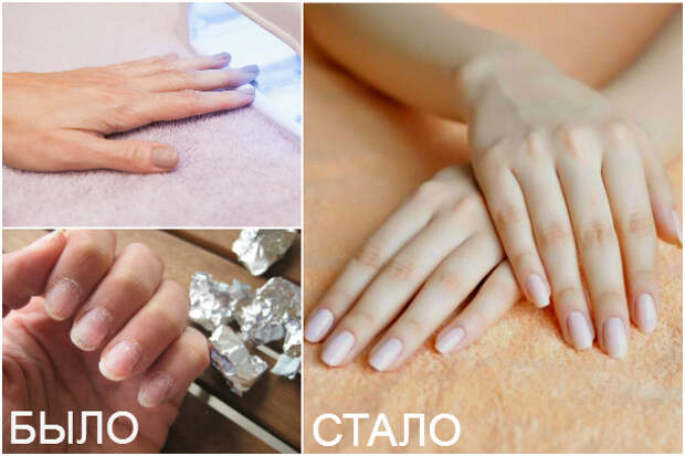 Спасти ногти после шеллака: это просто!