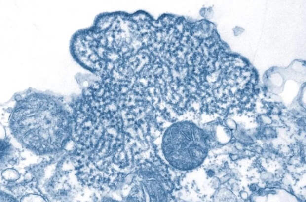 Врачи объяснили, как распознать смертельно опасный вирус Нипах вовремя