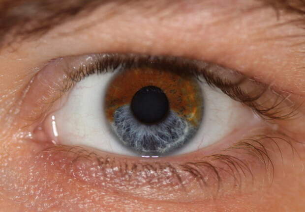 7 вещей, которые могут изменить цвет ваших глаз