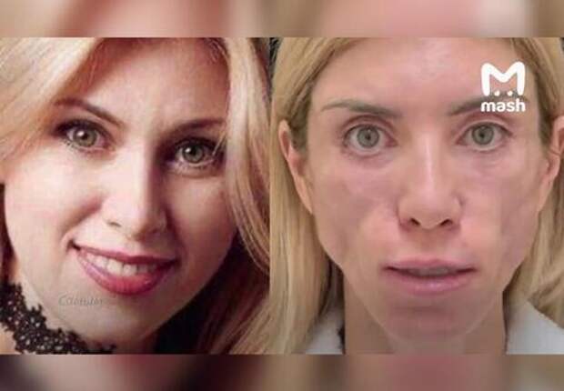 Не закрываются глаза: краснодарская клиника все-таки заплатит изуродованной девушке