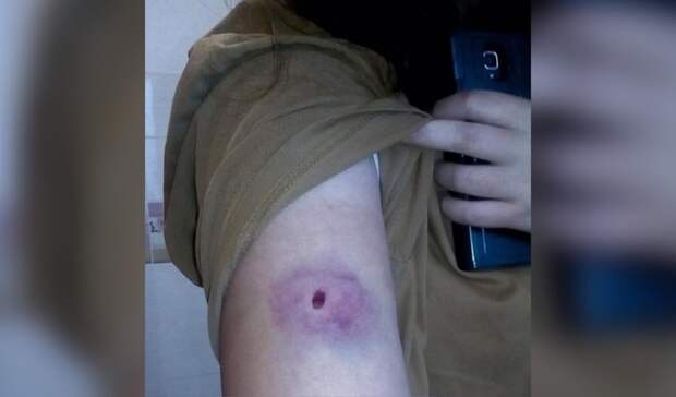 Неизвестный выстрелил в 16-летнюю девушку на Автозаводе