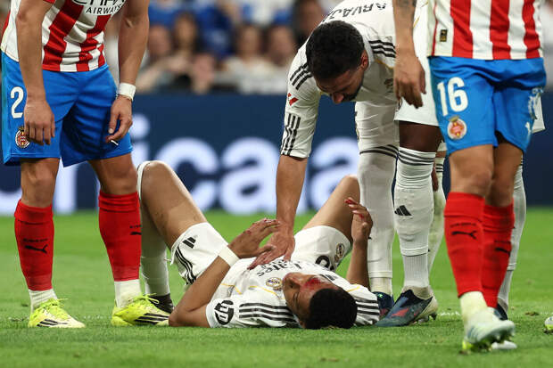 Игроку "Реала" Мбаппе разбили лицо в матче против "Жироны"