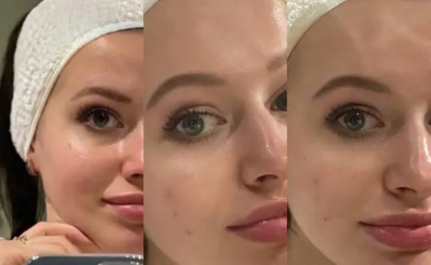 Как правильно подобрать средства ухода за кожей после зимы. На что нужно особенно обратить внимание