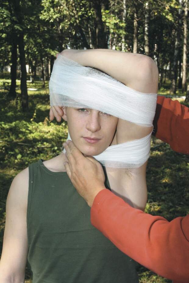 Наложение давящей повязки при повреждении сосудов на шее.