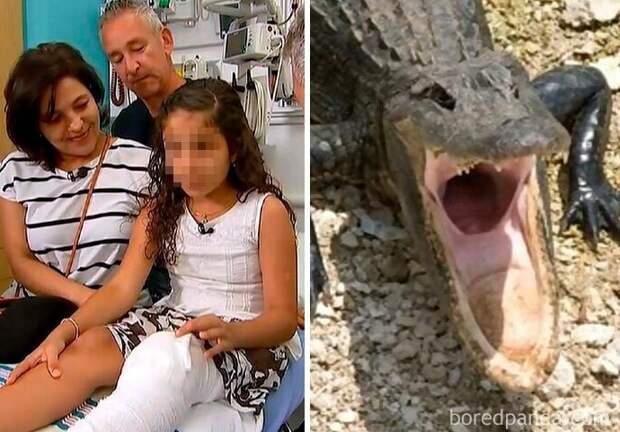 В 2017 году на 10-летнюю американку напал аллигатор. Девочка засунула два пальца в нос аллигатора, и тот открыл рот и освободил ее ногу