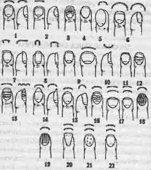 Диагностика по ногтям пальцев рук фото и описание
