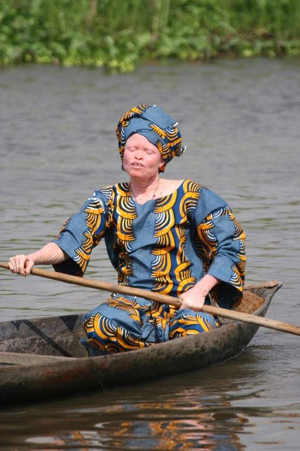 Albino_woman_in_canoe_Benin-610x915