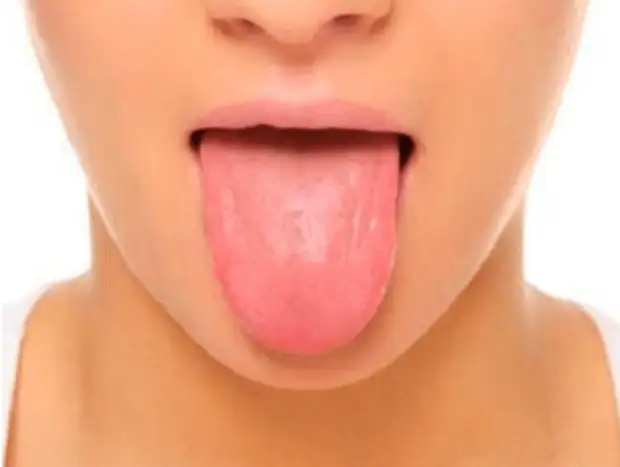 Что расскажет язык о вашем здоровье