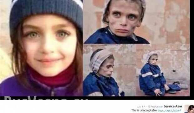 Чудовищная ложь западных и арабских СМИ о Сирии: трупы, изувеченные дети и голод в Мадайя (ФОТО) | Русская весна