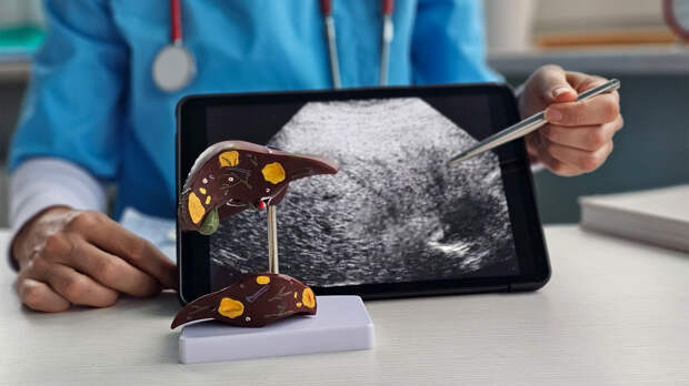 Врач предупредила: бессонница может оказаться симптомом болезни печени