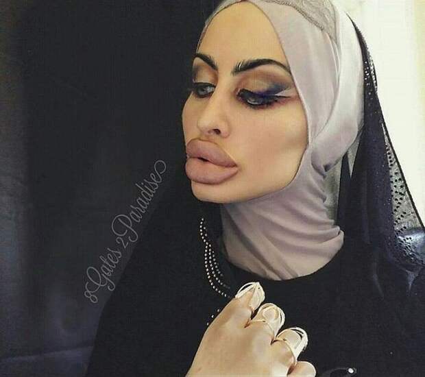 kogda_parandzha_neobkhodima_7_foto_3