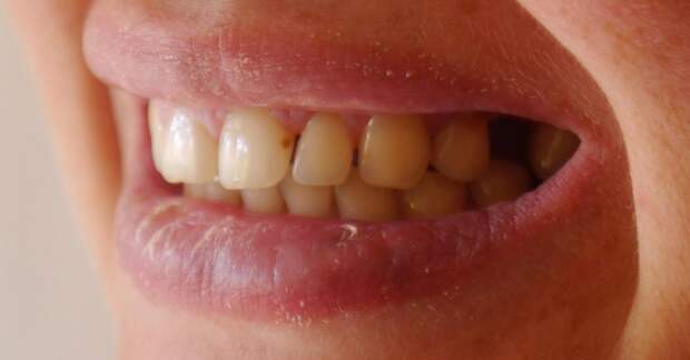 9. Плохие зубы Современное рабство, матрица