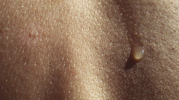 Врач Прокопьев объяснил, в чём опасность весенних лучей для кожи