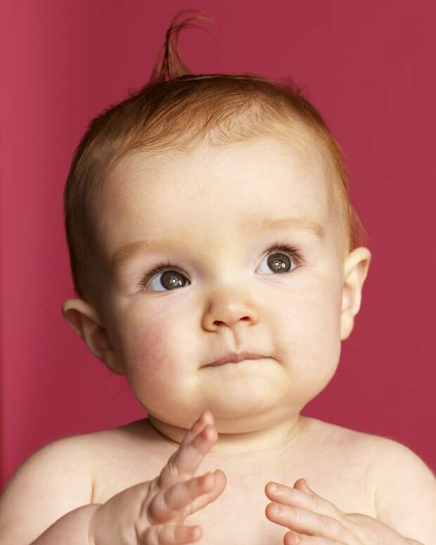 Рождение разговаривающего ребенка. Ихтиоз плода плод арлекина. Фото младенцев. Рождение разговаривающего ребенка. Мем уси говорят родить ребенка.