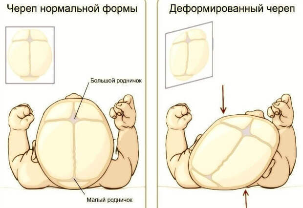 Лечение дисфункций височно-нижнечелюстного сустава