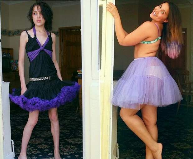 Девушка едва не умершая от анорексии набрала вес и публикует свои фото в бикини, чтобы помочь другим бывшая анорексичка размещает фото в бикини, бодипозитив, Меган Джейн, Megan Jayne