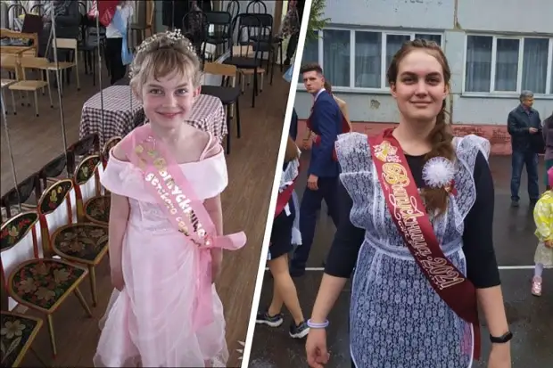 Всегда грустная: как выглядит девушка, которая ни разу в жизни не улыбалась, — она стала моделью, несмотря на редкую болезнь