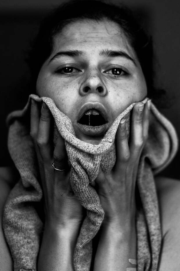 Автопортреты из психбольницы: шокирующие фото девушки, выжившей после попытки суицида