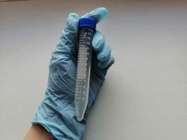 В Калужской области нашли зараженные персики и абрикосы