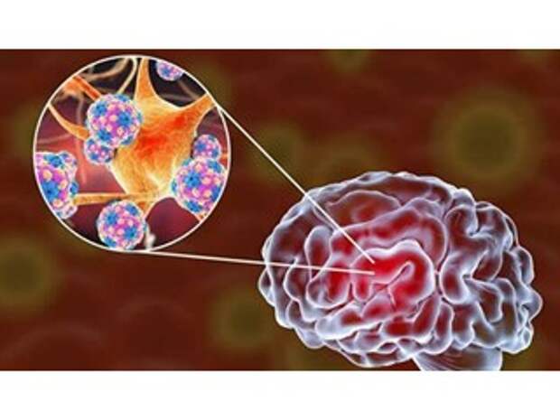 Ученые доказали, что коронавирус повреждает мозг. Какие последствия?