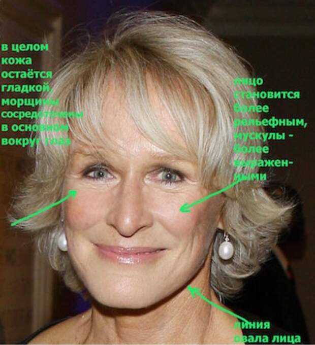 ТИПЫ СТАРЕНИЯ