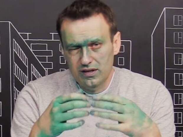 Навальный может навсегда остаться одноглазым