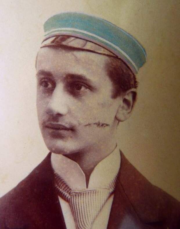 Старомодная тенденция: порез на щеке. / Фото: thevintagenews.com