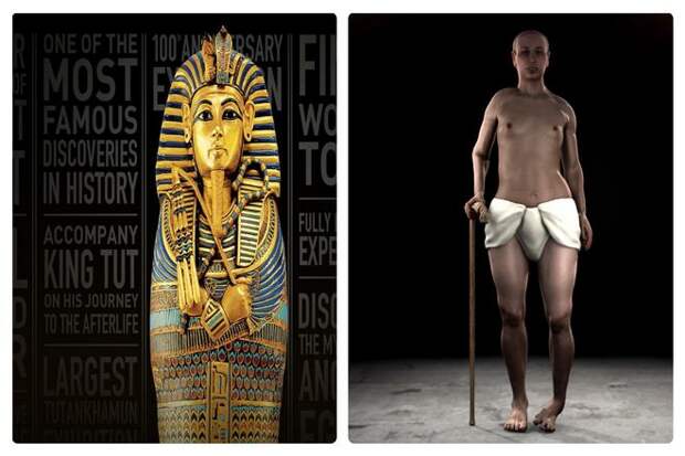 Другой, еще более известный пример: Тутанхамон. Он едва мог ходить. Из-за некроза левой стопы ему пришлось помогать себе тростью. Археологи нашли в его могиле более сотни тростей. Молекулярная генетика и компьютерная томография его мумии показали, что у него слабые кости и слабая иммунная система.
