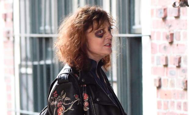 Сотрясение мозга, сломанный нос и синяки: что случилось со Сьюзан Сарандон