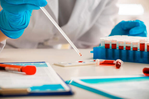 В России создали тест для диагностики инфаркта по капле крови за шесть минут