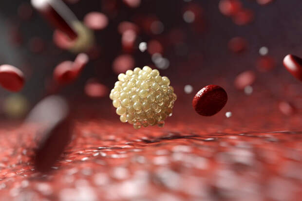 IJMS: холестерин вызывает перерождение рака простаты в агрессивную форму