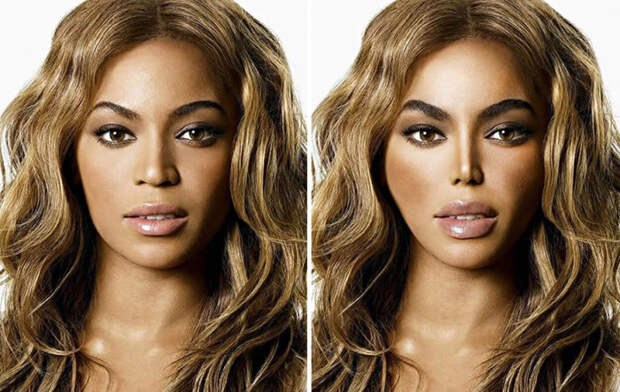 Так выглядело бы лицо известной американской певицы Бейонсе (Beyonce), если бы она легла под нож пластического хирурга.