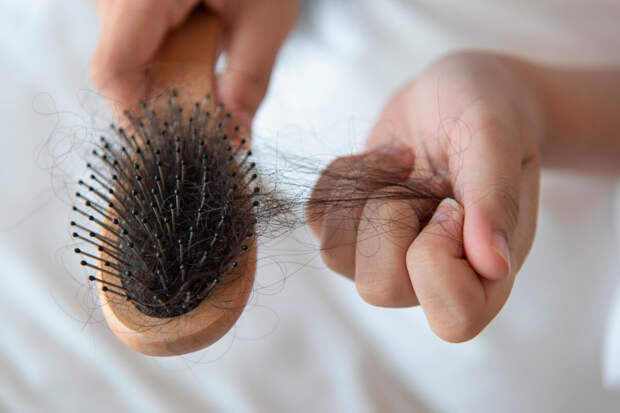 Live Science: выпадение волос вследствие стресса начинается не сразу