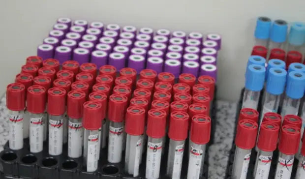 За 107 млн рублей передают лабораторию Глазова на аутсорсинг частнику