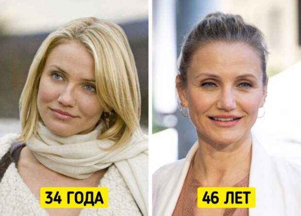Знаменитые женщины, которые отказались от уколов красоты