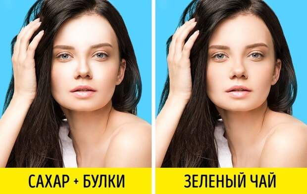 Почему расширяются поры и как с этим бороться