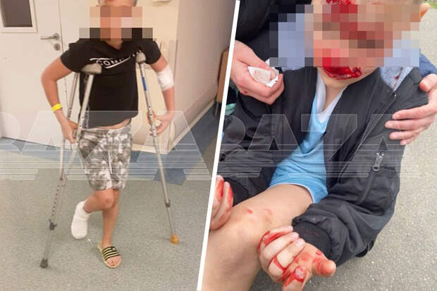В Москве двое подростков на электросамокате сбили школьника, мальчик в больнице