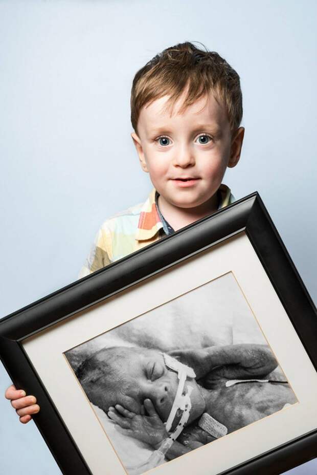 Вдохновляющие портреты людей, которые родились недоношенными и выжили
