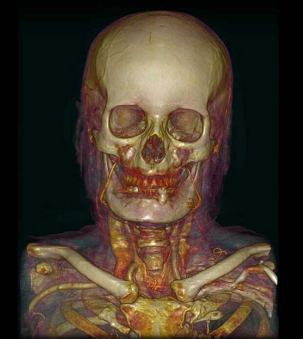 Взгляд на тело человека при помощи медицинских приборов